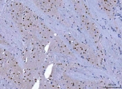 IHC staining of FFPE rat brain tissue with CHD1 antibody. HIER: boil tissue sections in pH8 EDTA for 20 min and allow to cool before testing.