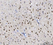 IHC staining of FFPE mouse brain tissue with CHD1 antibody. HIER: boil tissue sections in pH8 EDTA for 20 min and allow to cool before testing.