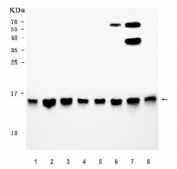 Western blot testing of human 1) HeLa, 2) HepG2, 3) PC-3, 4) 293T, 5) Caco-2, 6) MCF7, 7) HCCT and 8) HCCP cell lysate with COX5B antibody. Predicted molecular weight ~14 kDa.