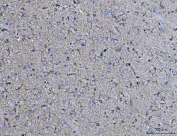 IHC staining of FFPE rat brain tissue with COX5B antibody. HIER: boil tissue sections in pH8 EDTA for 20 min and allow to cool before testing.