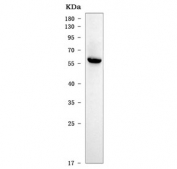 Western blot testing of human A549 cell lysate with CTSC antibody. Expected molecular weight ~55 kDa proenzyme form; the proenzyme form is processed into ~25 kDa and 8 kDa chains.