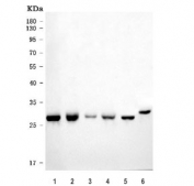 Western blot testing of 1) rat liver, 2) rat kidney, 3) rat RH35, 4) mouse liver, 5) mouse kidney and 6) mouse HEPA(1-6) cell lysate with ECHS1 antibody. Predicted molecular weight ~31 kDa, commonly observed at 27-31 kDa.