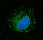 Immunofluorescent staining of FFPE human Caco-2 cells with ECHS1 antibody (green) and DAPI nuclear stain (blue). HIER: steam section in pH6 citrate buffer for 20 min.