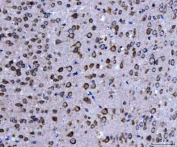 IHC staining of FFPE mouse brain tissue with EIF3A antibody. HIER: boil tissue sections in pH8 EDTA for 20 min and allow to cool before testing.