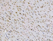 IHC staining of FFPE rat brain tissue with EIF3A antibody. HIER: boil tissue sections in pH8 EDTA for 20 min and allow to cool before testing.