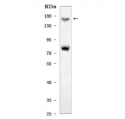Western blot testing of human HCCP cell lysate with CD135 antibody. Expected molecular weight: 113-160 kDa depending on level of glycosylation.