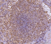 IHC staining of FFPE human spleen tissue with CD135 antibody. HIER: boil tissue sections in pH8 EDTA for 20 min and allow to cool before testing.