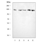 Western blot testing of human 1) MCF7, 2) Raji, 3) 293T, 4) Daudi and 5) MOLT4 cell lysate with Eg5 antibody. Predicted molecular weight ~119 kDa but commonly observed at 119-130 kDa.
