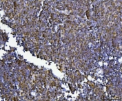 IHC staining of FFPE rat thymus tissue with KLF13 antibody. HIER: boil tissue sections in pH8 EDTA for 20 min and allow to cool before testing.