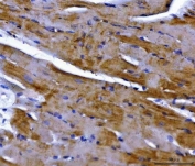 IHC staining of FFPE mouse heart tissue with NDUFS2 antibody. HIER: boil tissue sections in pH8 EDTA for 20 min and allow to cool before testing.