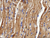 IHC staining of FFPE mouse heart tissue with NDUFS6 antibody. HIER: boil tissue sections in pH8 EDTA for 20 min and allow to cool before testing.
