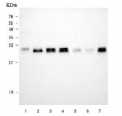 Western blot testing of human 1) HeLa, 2) HepG2, 3) A549, 4) MCF7, 5) Caco-2, 6) PC-3 and 7) 293T cell lysate with NDUFS8 antibody. Expected molecular weight ~23 kDa.
