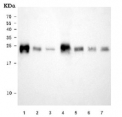 Western blot testing of 1) rat heart, 2) rat liver, 3) rat skeletal muscle, 4) mouse heart, 5) mouse liver, 6) mouse skeletal muscle and 7) mouse C2C12 cell lysate with NDUFS8 antibody. Expected molecular weight ~23 kDa.