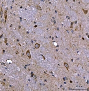 IHC staining of FFPE rat brain tissue with Nedd4 antibody. HIER: boil tissue sections in pH8 EDTA for 20 min and allow to cool before testing.