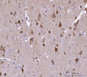 IHC staining of FFPE rat brain tissue with Nedd4 antibody. HIER: boil tissue sections in pH8 EDTA for 20 min and allow to cool before testing.