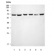 Western blot testing of human 1) HeLa, 2) K562, 3) HEL, 4) MOLT4, 5) U-251 and 6) HepG2 cell lysate with NOP58 antibody. Predicted molecular weight ~60 kDa, commonly observed at 58-65 kDa.