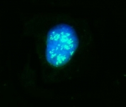 Immunofluorescent staining of FFPE human Caco-2 cells with NOP58 antibody (green) and DAPI nuclear stain (blue). HIER: steam section in pH6 citrate buffer for 20 min.