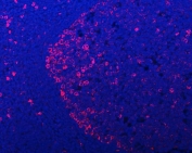 Immunofluorescent staining of FFPE human chronic tonsillitis tissue with APP-1 antibody (red) and DAPI nuclear stain (blue). HIER: steam section in pH8 EDTA buffer for 20 min.
