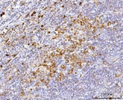 IHC staining of FFPE human tonsil tissue with APP-1 antibody. HIER: boil tissue sections in pH8 EDTA for 20 min and allow to cool before testing.