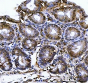 IHC staining of FFPE rat stomach tissue with PSMB4 antibody. HIER: boil tissue sections in pH8 EDTA for 20 min and allow to cool before testing.