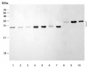 Western blot testing of 1) human HeLa, 2) human HepG2, 3) human A431, 4) human RT4, 5) human U-251, 6) human placenta, 7) human MCF7, 8) rat skeletal muscle, 9) mouse liver and 10) mouse skeletal muscle tissue lysate with PSMB4 antibody. Predicted molecular weight ~29 kDa, commonly observed at 26-29 kDa.