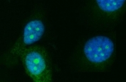 Immunofluorescent staining of FFPE human PC-3 cells with RRS1 antibody (green) and DAPI nuclear stain (blue). HIER: steam section in pH6 citrate buffer for 20 min.