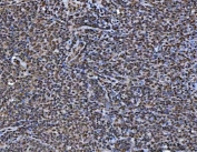 IHC staining of FFPE human tonsil tissue with TIP49A antibody. HIER: boil tissue sections in pH8 EDTA for 20 min and allow to cool before testing.