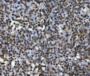 IHC staining of FFPE human spleen tissue with TIP49A antibody. HIER: boil tissue sections in pH8 EDTA for 20 min and allow to cool before testing.