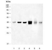 Western blot testing of 1) human Jurkat, 2) human MOLT4, 3) human Daudi, 4) rat thymus, 5) mouse thymus and 6) mouse EL-4 cell lysate with SEPTIN1 antibody. Predicted molecular weight ~42 kDa.