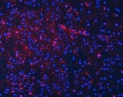 Immunofluorescent staining of FFPE mouse brain tissue with Septin 2 antibody (red) and DAPI nuclear stain (blue). HIER: steam section in pH8 EDTA buffer for 20 min.