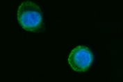 Immunofluorescent staining of FFPE human SiHa cells with Septin 2 antibody (green) and DAPI nuclear stain (blue). HIER: steam section in pH6 citrate buffer for 20 min.