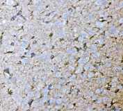 IHC staining of FFPE rat brain tissue with Septin 2 antibody. HIER: boil tissue sections in pH8 EDTA for 20 min and allow to cool before testing.