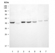 Western blot testing of 1) rat brain, 2) rat kidney, 3) rat testis, 4) rat C6, 5) mouse brain, 6) mouse testis and 7) mouse Neuro-2a cell lysate with Septin 2 antibody. Predicted molecular weight: ~41 kDa.