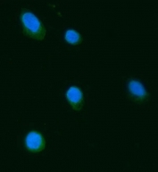 Immunofluorescent staining of FFPE human SiHa cells with SEPT3 antibody (green) and DAPI nuclear stain (blue). HIER: steam section in pH6 citrate buffer for 20 min.