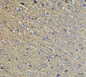 IHC staining of FFPE rat brain tissue with SEPT3 antibody. HIER: boil tissue sections in pH8 EDTA for 20 min and allow to cool before testing.