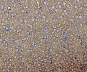 IHC staining of FFPE mouse brain tissue with SEPT3 antibody. HIER: boil tissue sections in pH8 EDTA for 20 min and allow to cool before testing.