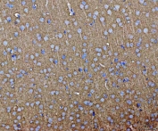 IHC staining of FFPE mouse brain tissue with SEPT3 antibody. HIER: boil tissue sections in pH8 EDTA for 20 min and allow to cool before testing.