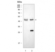 Western blot testing of 1) rat brain and 2) mouse brain tissue lysate with SEPT4 antibody. Predicted molecular weight ~53 kDa.