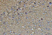 IHC staining of FFPE rat brain tissue with SEPT7 antibody. HIER: boil tissue sections in pH8 EDTA for 20 min and allow to cool before testing.