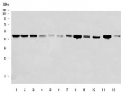 Western blot testing of 1) human HeLa, 2) human MCF7, 3) human HepG2, 4) human A431, 5) human U-2 OS, 6) human A375, 7) rat testis, 8) rat brain, 9) rat stomach, 10) rat PC-12, 11) mouse brain and 12) mouse Neuro-2a cell lysate with SEPT7 antibody. Predicted molecular weight ~51 kDa.