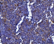 IHC staining of FFPE mouse lymph tissue with SEPT9 antibody. HIER: boil tissue sections in pH8 EDTA for 20 min and allow to cool before testing.