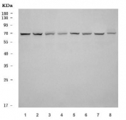 Western blot testing of human 1) HeLa, 2) MOLT4, 3) HepG2, 4) A549, 5) Daudi, 6) RT4, 7) SH-SY5Y and 8) PC-3 cell lysate with SEPT9 antibody. Predicted molecular weight: 48-65 kDa (multiple isoforms).