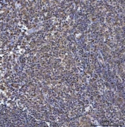 IHC staining of FFPE human tonsil tissue with TIP3 antibody. HIER: boil tissue sections in pH8 EDTA for 20 min and allow to cool before testing.