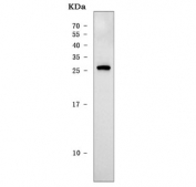 Western blot testing of human K562 cell lysate with TIP3 antibody. Predicted molecular weight ~24 kDa.
