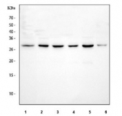 Western blot testing of 1) rat spleen, 2) rat PC-12, 3) mouse spleen, 4) mouse RAW264.7, 5) mouse Ana-1 and 6) mouse EL-4 cell lysate with TIP3 antibody. Predicted molecular weight ~24 kDa.