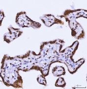 IHC staining of FFPE human placental tissue with TARBP2 antibody. HIER: boil tissue sections in pH8 EDTA for 20 min and allow to cool before testing.