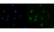 Immunofluorescent staining of FFPE human A549 cells with TARBP2 antibody (green) and DAPI nuclear stain (blue). HIER: steam section in pH6 citrate buffer for 20 min.