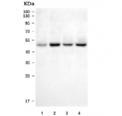 Western blot testing of human 1) HeLa, 2) 293T, 3) HepG2 and 3) HL60 cell lysate with TARBP antibody. Predicted molecular weight ~39 kDa.