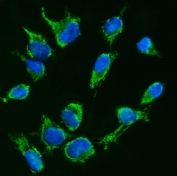 Immunofluorescent staining of FFPE human HeLa cells with Transcription factor EB antibody (green) and DAPI nuclear stain (blue). HIER: steam section in pH6 citrate buffer for 20 min.