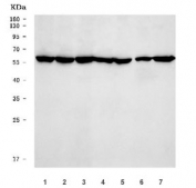 Western blot testing of human 1) K562, 2) 293T, 3) HeLa, 4) HepG2, 5) A549, 6) Raji and 7) SW620 cell lysate with TFEB antibody. Expected molecular weight: 53-60 kDa (unmodified), 65-70 kDa (modified).